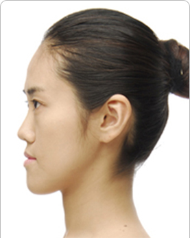 �ذ��참��1