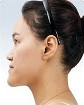 �ذ��참��2