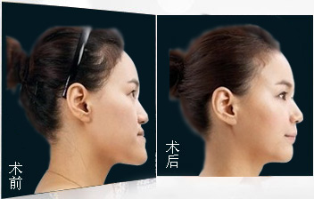 ����ӵ�����ذ��참��
