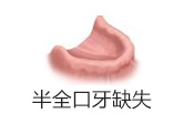 ��ȫ����ȱʧ